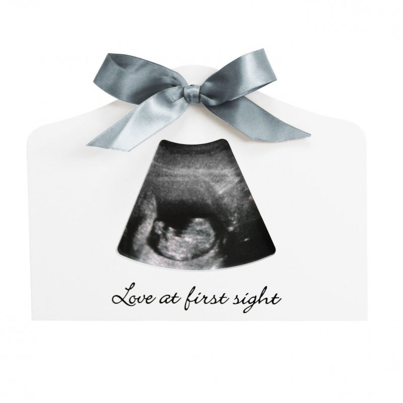 Produkt - Sonogram Echo Frame